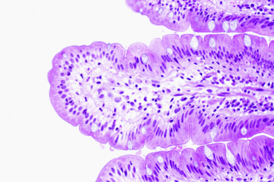 Intestin grêle - extrémité d'une villosité x100